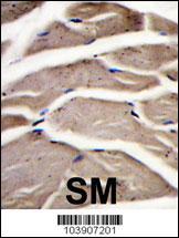 Formalin-fixed and paraffin-embedded human skeletal muscle reacted with PFKM Antibody , which was peroxidase-conjugated to the secondary antibody, followed by DAB staining. This data demonstrates the use of this antibody for immunohistochemistry; clinical relevance has not been evaluated.
