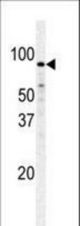 Western blot of PFKM polyclonal antibody in HeLa cell line lysate. PFKM(arrow) was detected using the purified antibody.