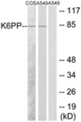 Western blot of extracts from A549/COS7 cells, using K6PP Antibody. The lane on the right is treated with the synthesized peptide.