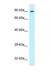 PFKP antibody LS-C145348 Western blot of 8226 Cell lysate. Antibody concentration 1 ug/ml.