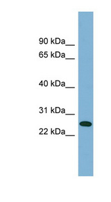 ITGB1BP3 antibody LS-C110714 Western blot of Fetal Thymus lysate.