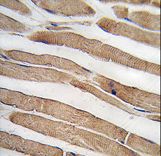 Formalin-fixed and paraffin-embedded human skeletal muscle tissue reacted with ITGB1BP3 antibody , which was peroxidase-conjugated to the secondary antibody, followed by DAB staining. This data demonstrates the use of this antibody for immunohistochemistry; clinical relevance has not been evaluated.