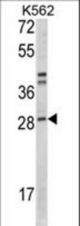 Western blot of ITGB1BP3 Antibody in K562 cell line lysates (35 ug/lane). ITGB1BP3 (arrow) was detected using the purified antibody.