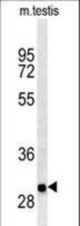 ITGB1BP3 Antibody western blot of mouse testis tissue lysates (35 ug/lane). This demonstrates ITGB1BP3 antibody detected ITGB1BP3 protein (arrow).