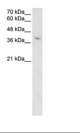 Jurkat Cell Lysate
