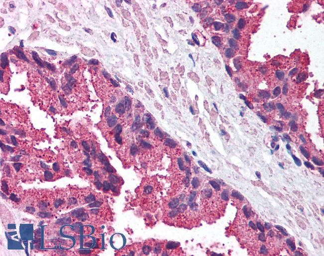 Anti-MICA antibody IHC of human prostate. Immunohistochemistry of formalin-fixed, paraffin-embedded tissue after heat-induced antigen retrieval. Antibody LS-B1377 concentration 5 ug/ml.