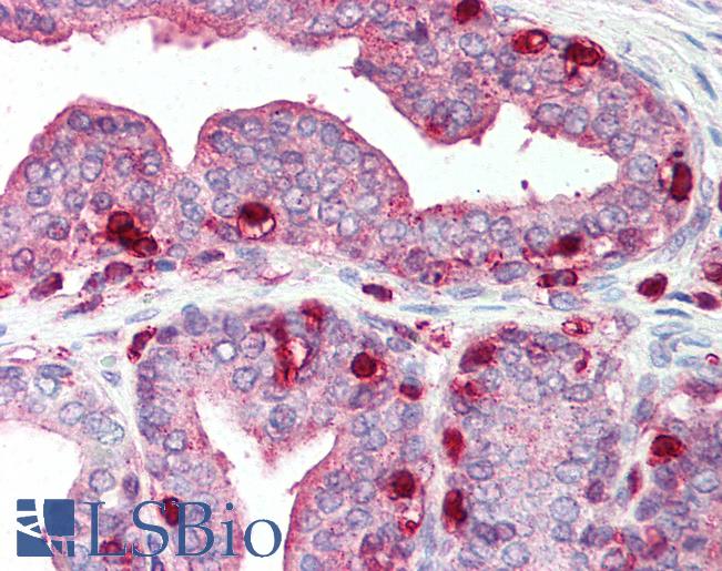 Anti-PFN1 / Profilin 1 antibody IHC of human prostate. Immunohistochemistry of formalin-fixed, paraffin-embedded tissue after heat-induced antigen retrieval. Antibody LS-B292 concentration 2.5 ug/ml.