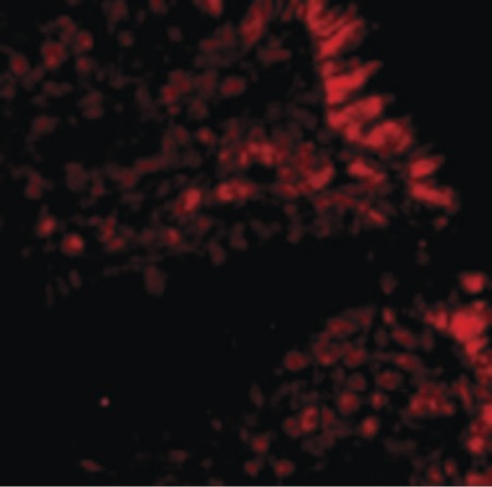 Immunofluorescence of MICA in Human Colon cells with MICA antibody at 20 ug/ml.