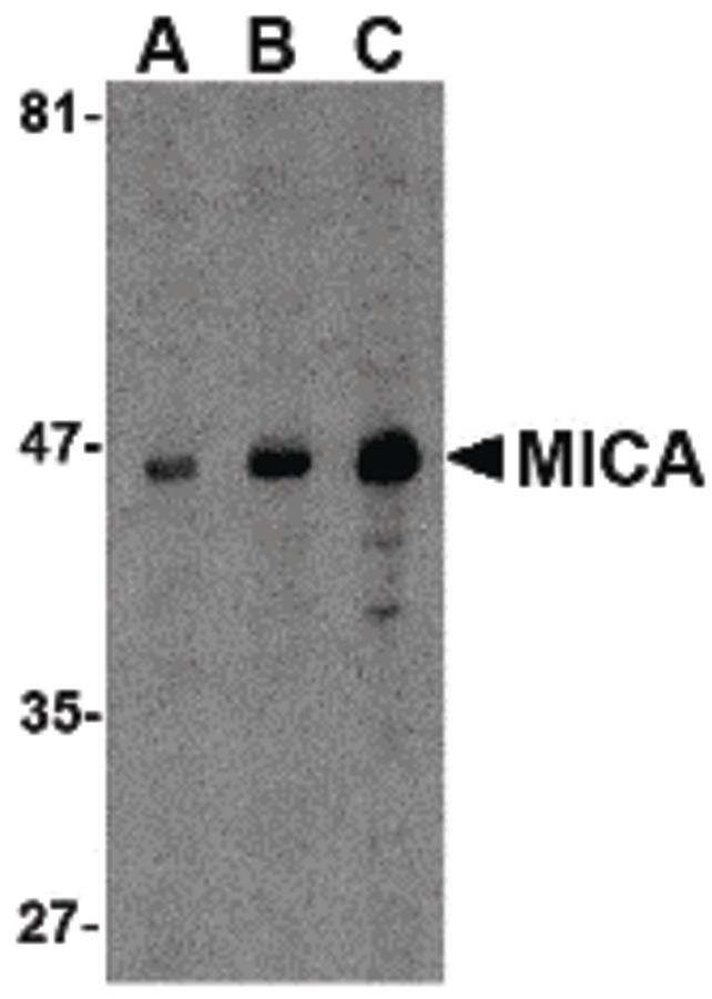 Western blot of MICA in A-20 cell lysate with MICA antibody at (A) 0.5, (B) 1 and (C) 2 ug/ml.