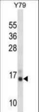 PFN2 Antibody western blot of Y79 cell line lysates (35 ug/lane). The PFN2 antibody detected the PFN2 protein (arrow).