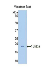 Western blot of recombinant PFN2 / Profilin 2.