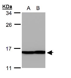 Sample (30 ug whole cell lysate). A: A431, B: H1299. 12% SDS PAGE. Profilin 2 antibody diluted at 1:500