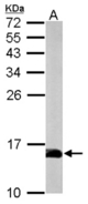 Sample (50 ug of whole cell lysate). A: mouse brain. 15% SDS PAGE. Profilin 2 antibody diluted at 1:1000.