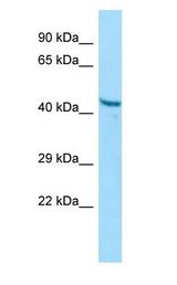 PGA3 antibody Western Blot of A549.