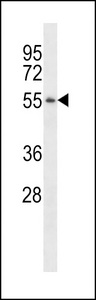 PGA3 Antibody western blot of MDA-MB231 cell line lysates (35 ug/lane). The PGA3 antibody detected the PGA3 protein (arrow).