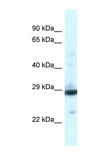 PGAM1 antibody LS-C145515 Western blot of Fetal Liver lysate. Antibody concentration 1 ug/ml.
