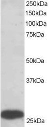 Antibody staining (0.5 ug/ml) of human liver lysate (RIPA buffer, 35 ug total protein per lane). Primary incubated for 1 hour. Detected by Western blot of chemiluminescence.