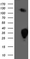 HEK293T cells were transfected with the pCMV6-ENTRY control (Left lane) or pCMV6-ENTRY PGAM2 (Right lane) cDNA for 48 hrs and lysed. Equivalent amounts of cell lysates (5 ug per lane) were separated by SDS-PAGE and immunoblotted with anti-PGAM2.