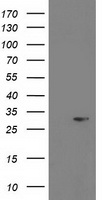 HEK293T cells were transfected with the pCMV6-ENTRY control (Left lane) or pCMV6-ENTRY PGAM2 (Right lane) cDNA for 48 hrs and lysed. Equivalent amounts of cell lysates (5 ug per lane) were separated by SDS-PAGE and immunoblotted with anti-PGAM2.
