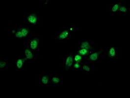 Immunofluorescent staining of HeLa cells using anti-PGAM2 mouse monoclonal antibody.
