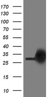 HEK293T cells were transfected with the pCMV6-ENTRY control (Left lane) or pCMV6-ENTRY PGAM2 (Right lane) cDNA for 48 hrs and lysed. Equivalent amounts of cell lysates (5 ug per lane) were separated by SDS-PAGE and immunoblotted with anti-PGAM2.