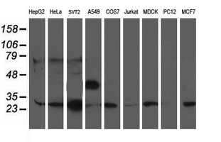 Western blot of extracts (35 ug) from 9 different cell lines by using anti-PGAM2 monoclonal antibody.