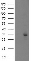 HEK293T cells were transfected with the pCMV6-ENTRY control (Left lane) or pCMV6-ENTRY PGAM2 (Right lane) cDNA for 48 hrs and lysed. Equivalent amounts of cell lysates (5 ug per lane) were separated by SDS-PAGE and immunoblotted with anti-PGAM2.