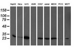 Western blot of extracts (35 ug) from 9 different cell lines by using anti-PGAM2 monoclonal antibody.