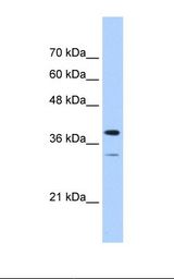 Jurkat cell lysate. Antibody concentration: 1.0 ug/ml. Gel concentration: 12%.