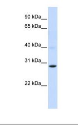 Fetal muscle lysate. Antibody concentration: 1.0 ug/ml. Gel concentration: 12%.