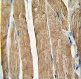 PGAM2 antibody immunohistochemistry of formalin-fixed and paraffin-embedded human skeletal muscle followed by peroxidase-conjugated secondary antibody and DAB staining.
