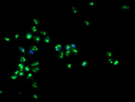 Immunofluorescent staining of HeLa cells using anti-PGAM2 mouse monoclonal antibody.