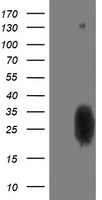 HEK293T cells were transfected with the pCMV6-ENTRY control (Left lane) or pCMV6-ENTRY PGAM2 (Right lane) cDNA for 48 hrs and lysed. Equivalent amounts of cell lysates (5 ug per lane) were separated by SDS-PAGE and immunoblotted with anti-PGAM2.