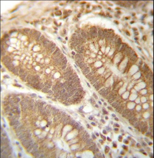PGAM4 Antibody immunohistochemistry of formalin-fixed and paraffin-embedded human colon tissue followed by peroxidase-conjugated secondary antibody and DAB staining.