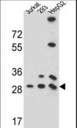 PGAM4 Antibody western blot of 293,HepG2,Jurkat cell line lysates (35 ug/lane). The PGAM4 antibody detected the PGAM4 protein (arrow).