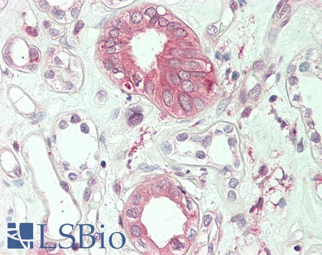 Human Kidney: Formalin-Fixed, Paraffin-Embedded (FFPE)