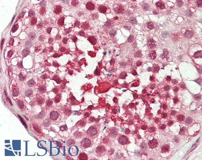 Human Testis: Formalin-Fixed, Paraffin-Embedded (FFPE)