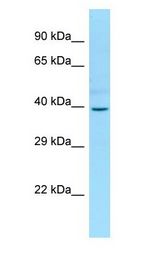 PGBD2 antibody Western Blot of Fetal Small Intestine.