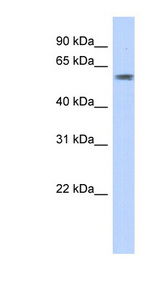 PGBD3 antibody LS-C110173 Western blot of Transfected 293T cell lysate.