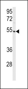 Western blot of anti-CYP8A1 Antibody in mouse lung tissue lysates (35 ug/lane). CYP8A1(arrow) was detected using the purified antibody.