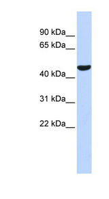 PTGIS antibody LS-C110940 Western blot of Fetal Brain lysate.