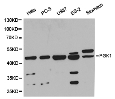 Western blot of extracts of various cell lines, using PGK1 antibody.