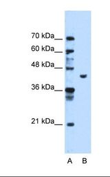 Lane A: Marker. Lane B: HepG2 cell lysate. Antibody concentration: 1.25 ug/ml. Gel concentration: 12%.
