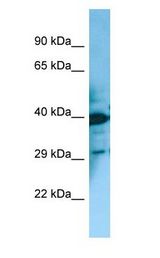 MCHR2 antibody Western Blot of Fetal Bladder.