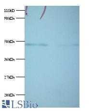 Western blot of Phosphoglycerate kinase 1 antibody at 2 ug/ml. Lane 1: EC109 whole cell lysate. Lane 2: 293T whole cell lysate. Secondary: Goat polyclonal to Rabbit IgG at 1:15000 dilution. Predicted band size: 46 kDa. Observed band size: 46 kDa.