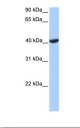 Placenta lysate. Antibody concentration: 1.0 ug/ml. Gel concentration: 12%.