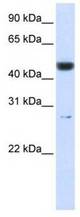 Western analysis of 721_B cell lysate.