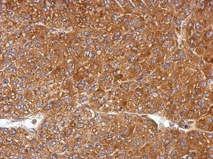 IHC of paraffin-embedded U87 xenograft, using PGLS antibody at 1:500 dilution.