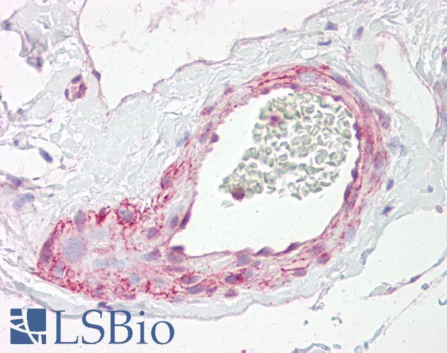 Anti-PGLS / 6PGL antibody IHC of human vessel. Immunohistochemistry of formalin-fixed, paraffin-embedded tissue after heat-induced antigen retrieval. Antibody LS-B7685 dilution 10 ug/ml.