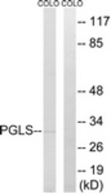 Western blot of extracts from COLO cells, using PGLS Antibody. The lane on the right is treated with the synthesized peptide.